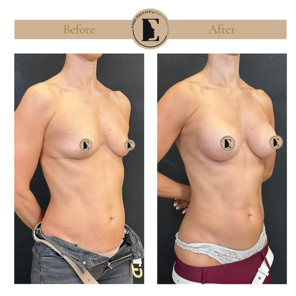 MIA Femtech before after result 1 Cup up